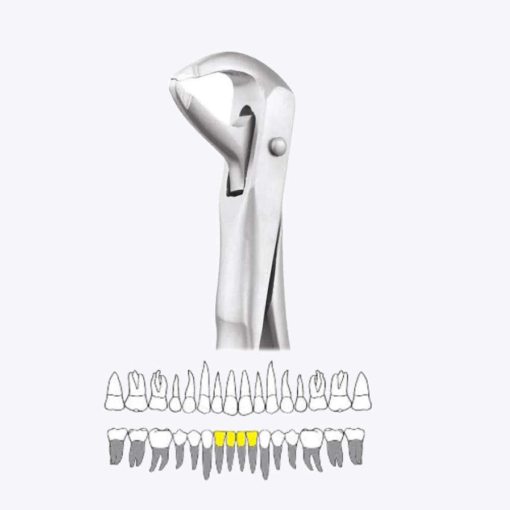 GDC Extraction Forceps Lower Roots - 74n Atraumatic (Afx74n)